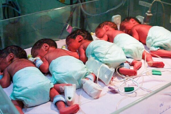 تولد نوزادان ۵ قلو در ماکو